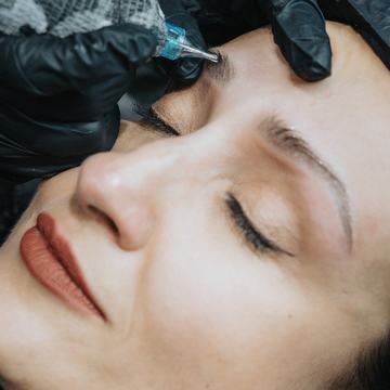 tatuiruotės šviesinimas rimuveriu procedūros metu