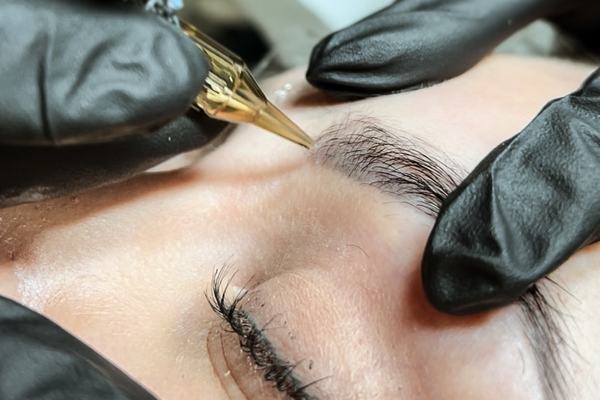 tattoo lightening procedure using remover