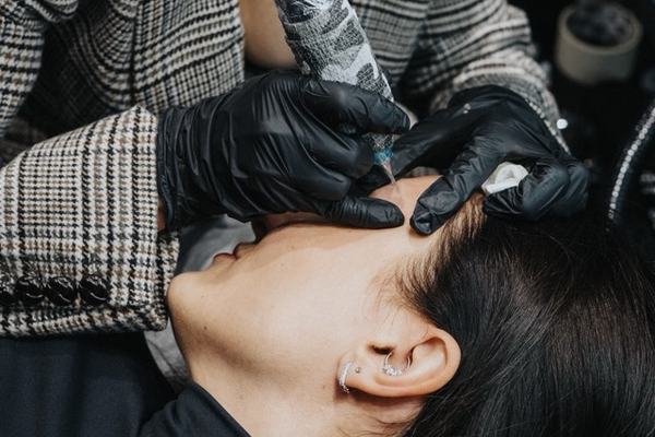 Tatuiruotės šviesinimo rimuveriu procedūra