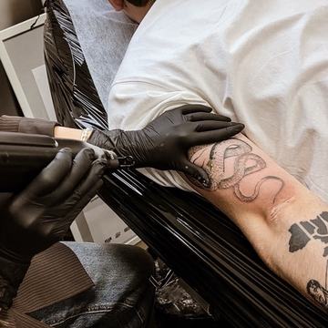 tattoo laser lightening procedure