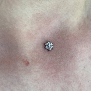 Microdermal16