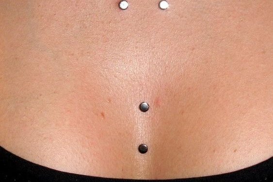 Microdermal3