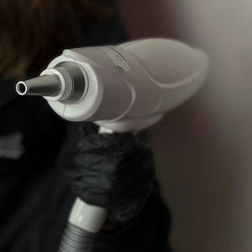 Darbas su lazeriu šviesinant permanentinį makiažą