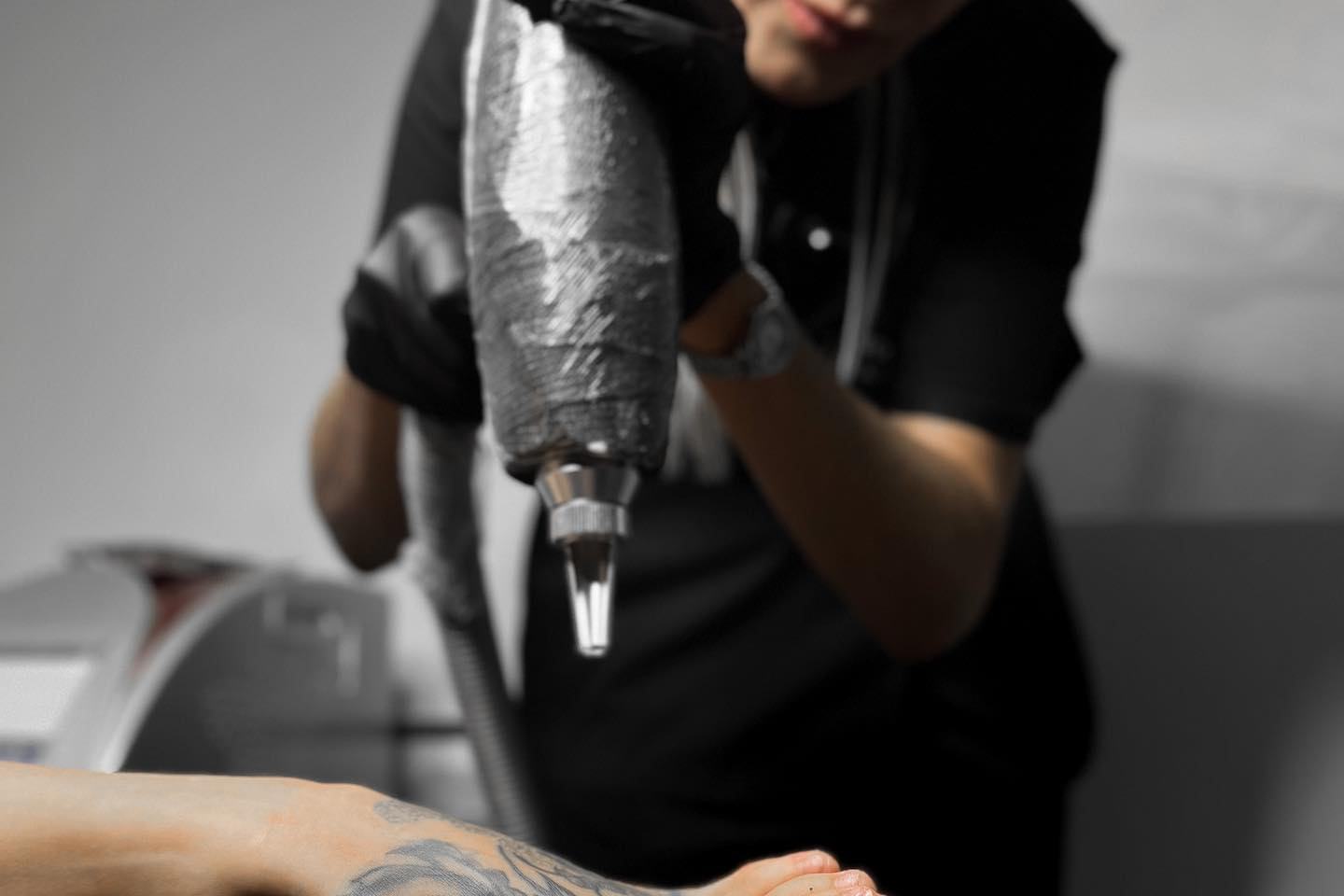 tatuiruotės šviesinimo lazeriu procedūra