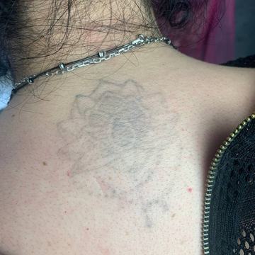 tattoo remover lightening training during practical course